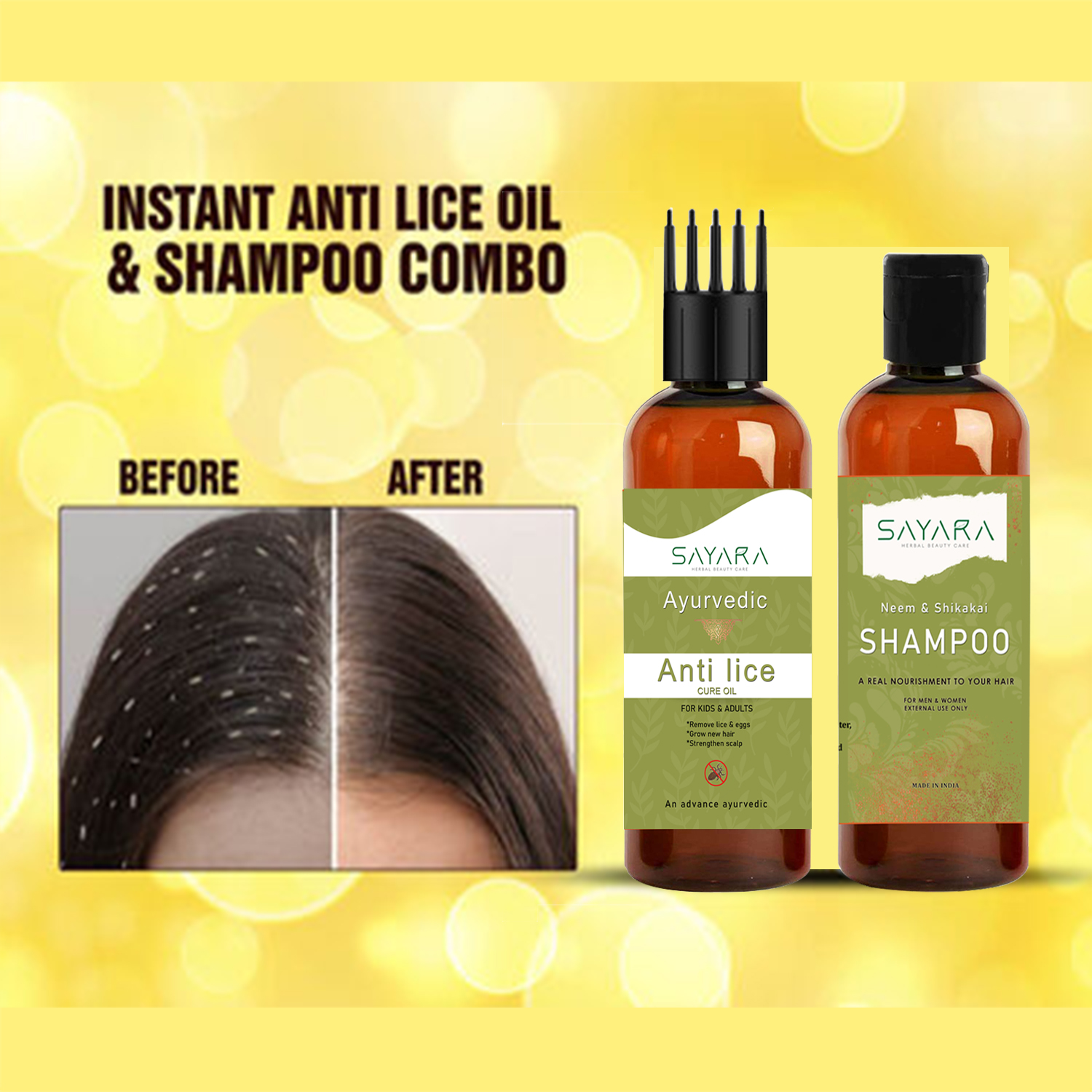 New lice