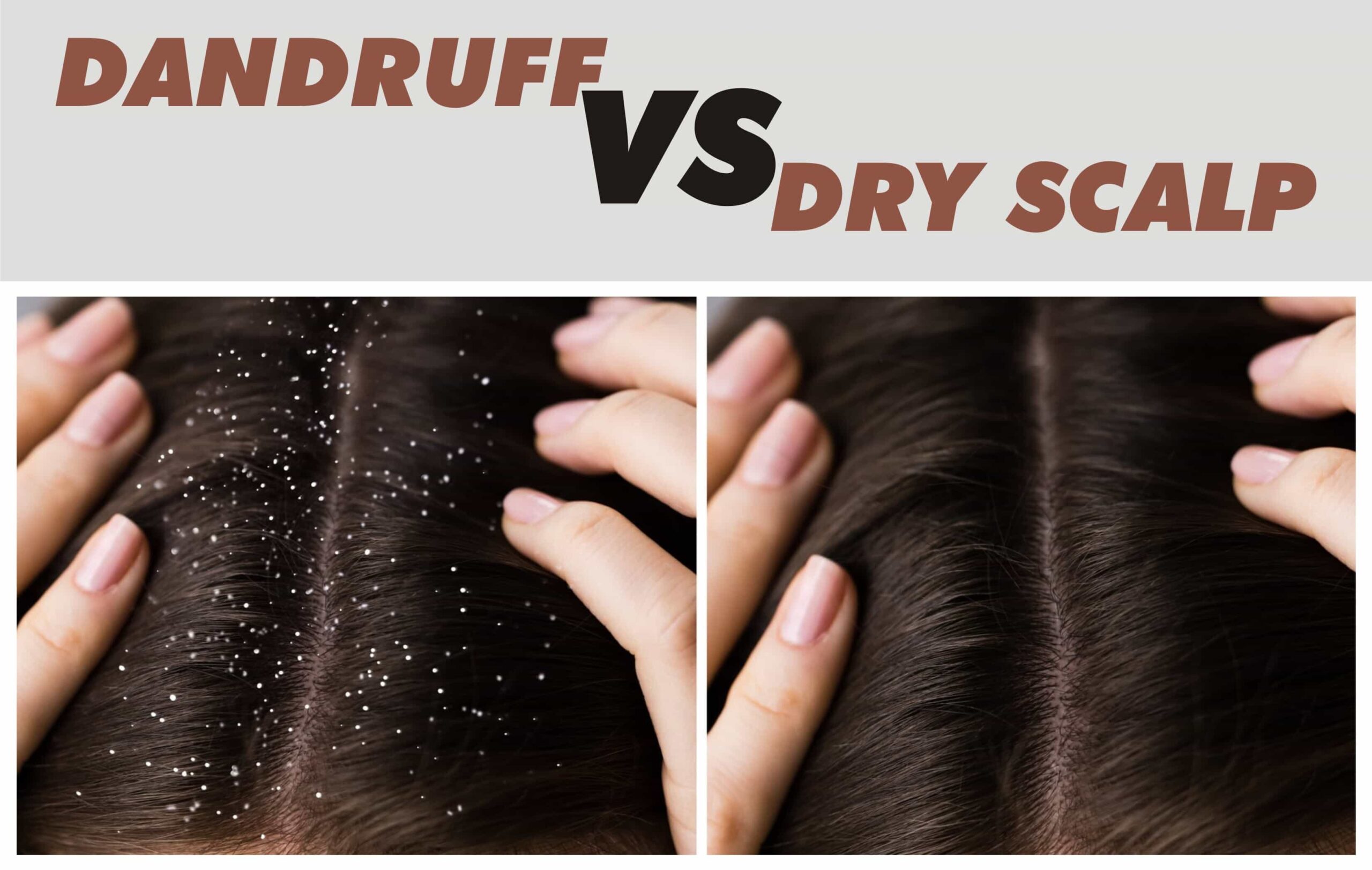 Neem and Shikakai shampoo For Dry and Oily Dandruff instant result just in a Month 100g - Image 3